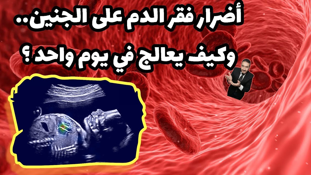 أضرار فقر الدم والأنيميا على الجنين والحامل وكيف تعالج في يوم واحد فقط