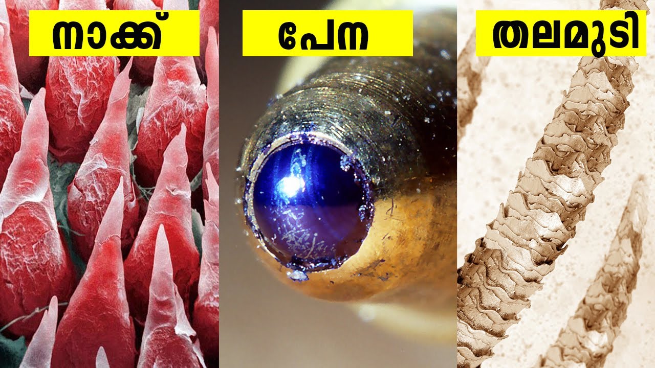 തലമുടിയൊക്കെ ഇങ്ങനെ ആയിരുന്നോ?? മൈക്രോസ്കോപ്പിലൂടെ മാത്രം കാണാവുന്ന കാഴ്ച്ചകൾ | Microscope Images
