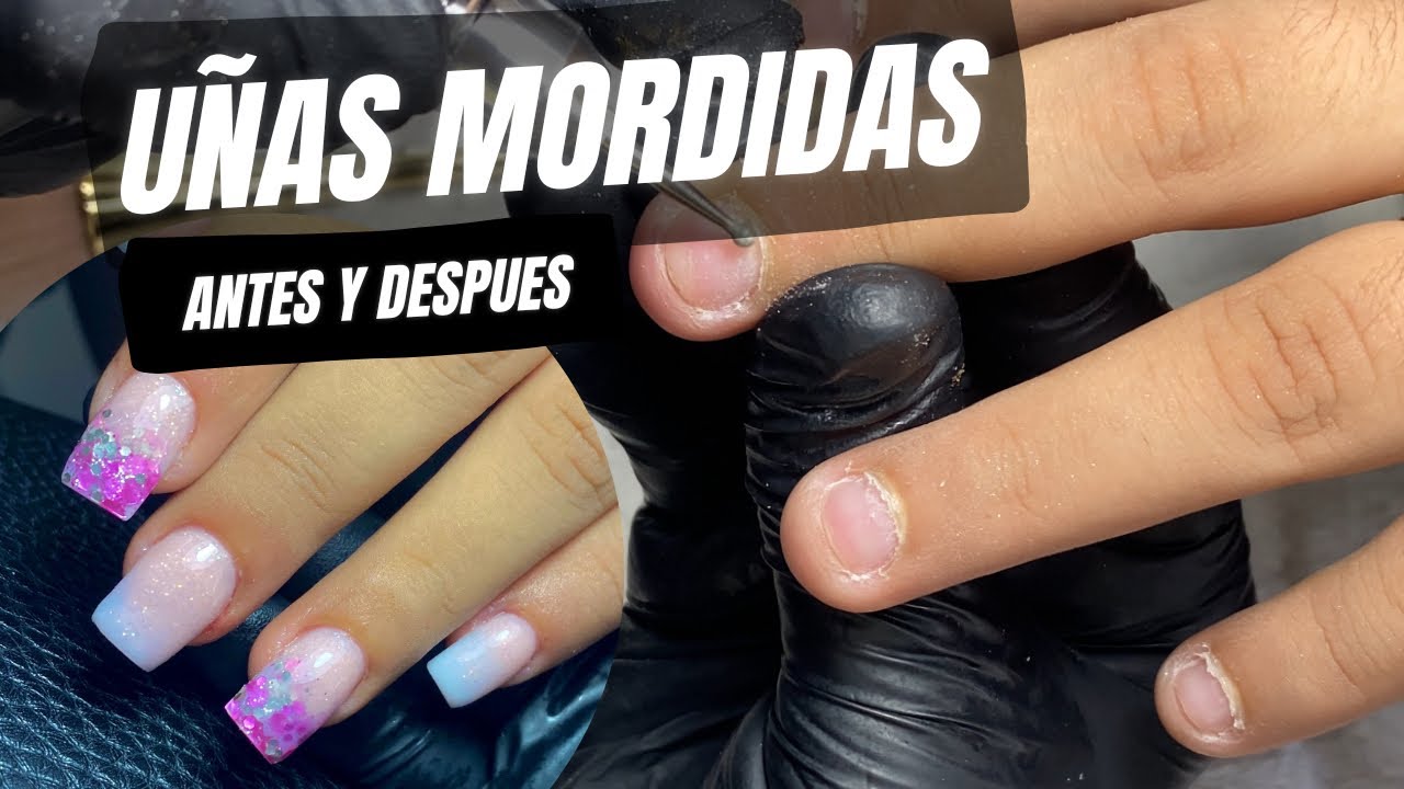 UÑAS MORDIDAS /ONICOFAGIA/ Como aplicarle uñas acrílicas paso a paso