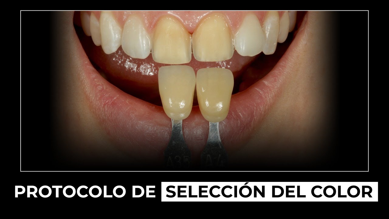 #MAXIMICESUPOTENCIAL | Protocolo de selección del color | Milko Villarroel