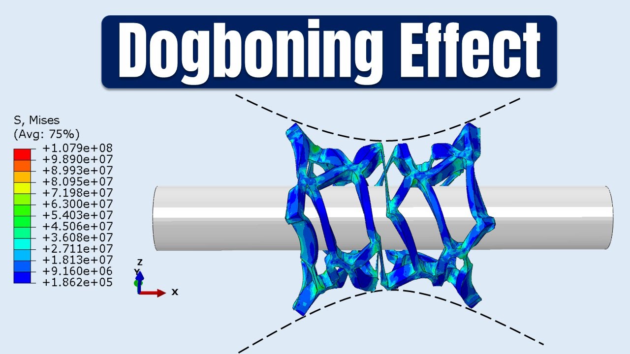 How to find the Dogboning Effect from  a Stent Simulation