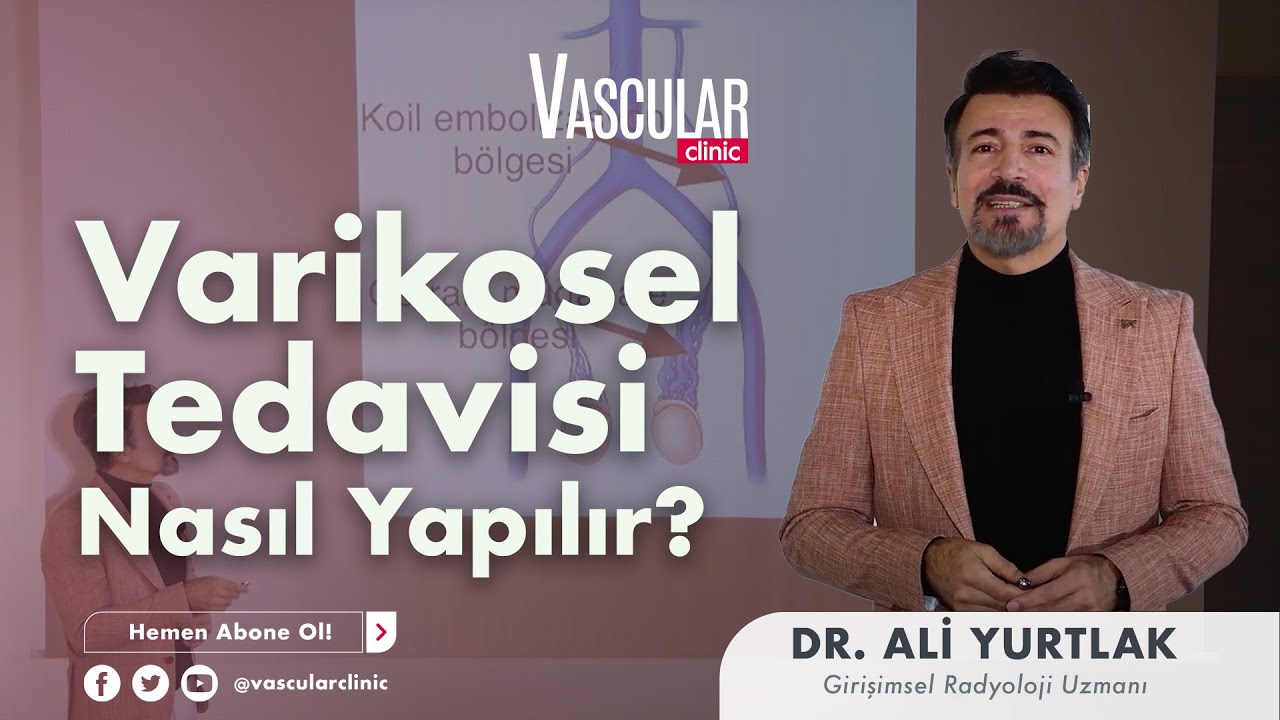 Varikosel Tedavisi Nasıl Yapılır? | Girişimsel Radyoloji Uzmanı Ali Yurtlak