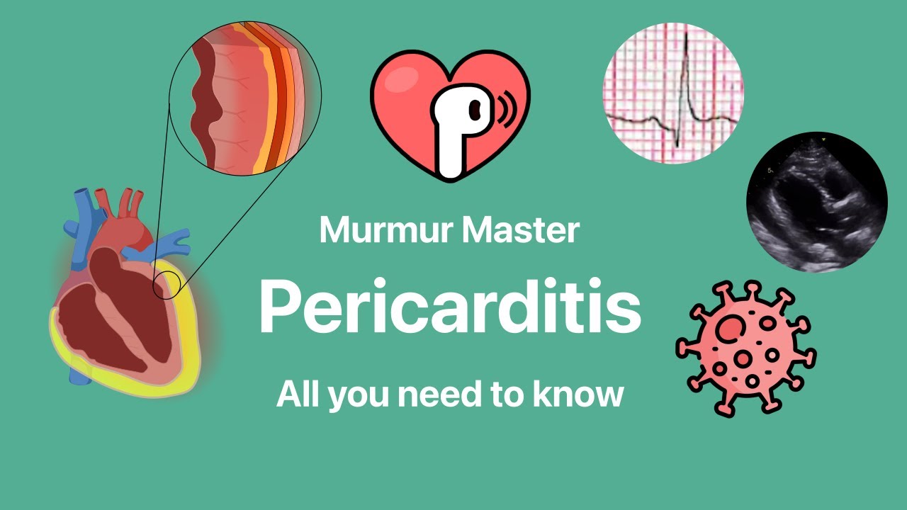 Pericarditis in 2026 (all you need to know with heart sounds)