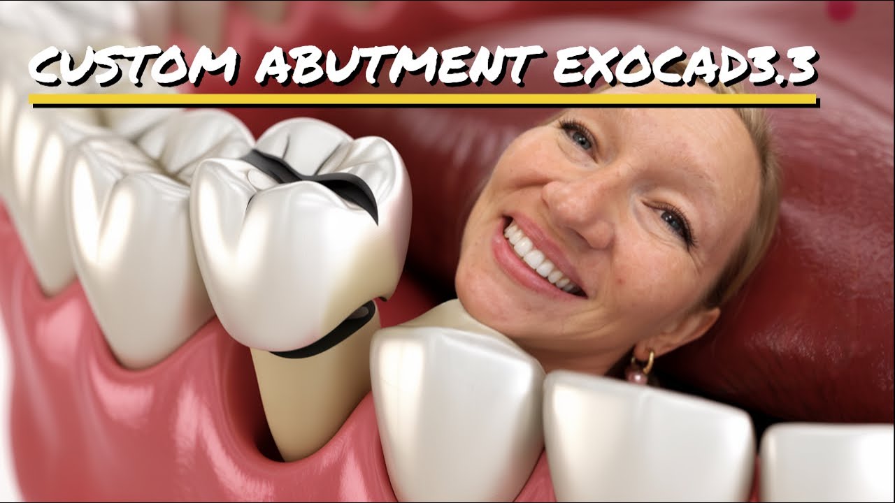 HOW TO DESIGN COUSTEM ABUTMENT IN EXOCAD 3.3