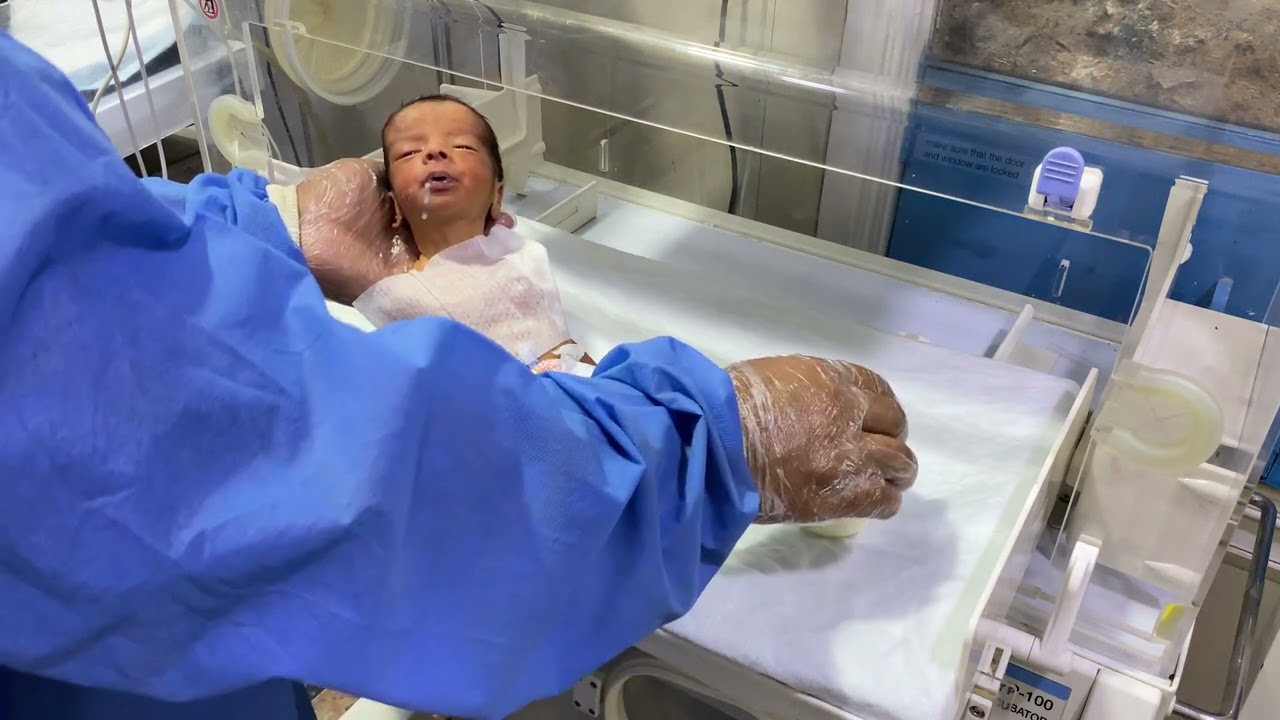 Cute Premature Baby in NICU | Recovery from RDS & ENNS | First Formula Milk & Phototherapy 🌞🍼