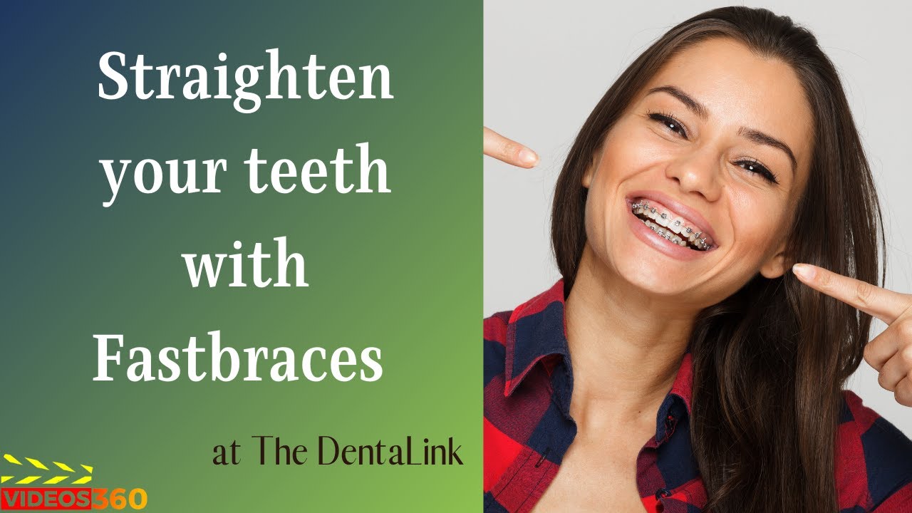 Fastbraces at The DentaLink