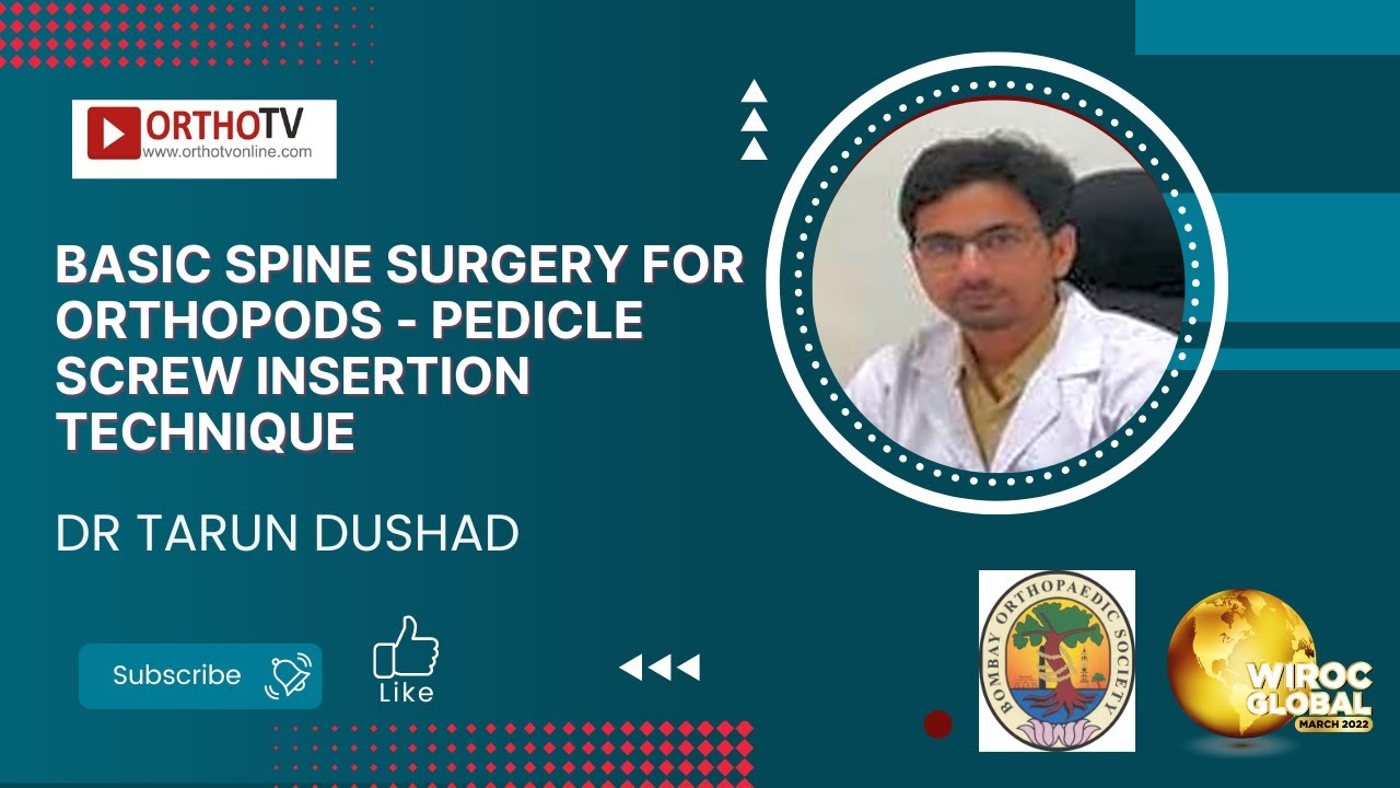 BASIC SPINE SURGERY FOR ORTHOPODS - Pedicle Screw Insertion Technique - Dr Tarun Dushad