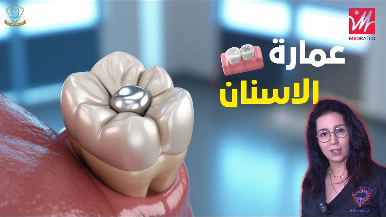 عمارة او حشوات الاسنان على ميد راديو... خطيييييير !!
