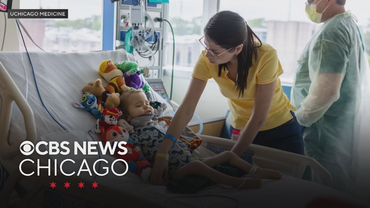 UChicago Medicine doctor helps German 2-year-old with spinal injury