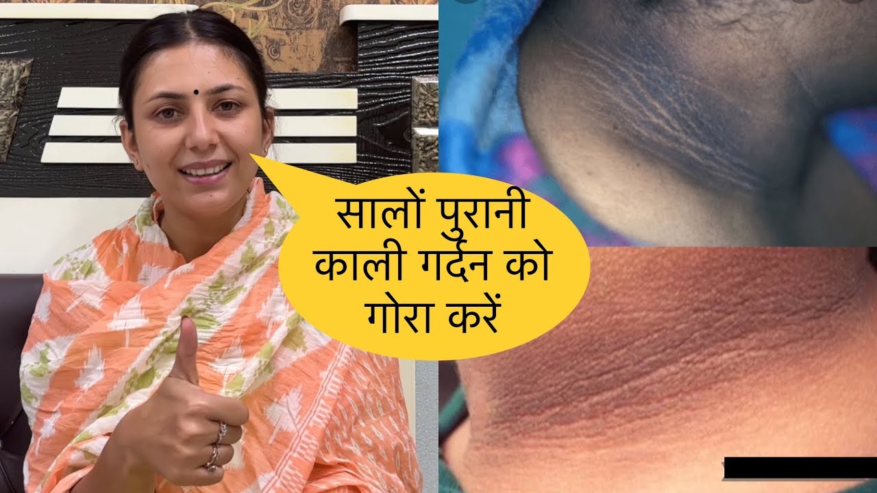Kaali Gardan Gori Kare | Gardan Ka Kalapan Door Kare | Dark Neck Home Remedy | Dr. Upasana Vohra