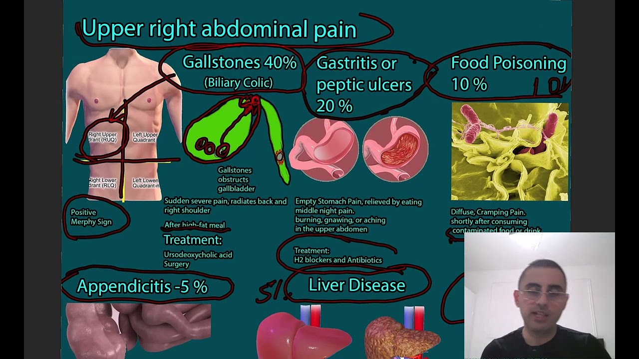 Right Upper abdominal Pain Symptoms, causes and treatment.