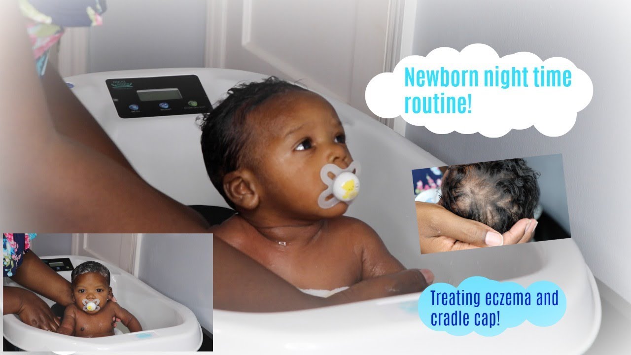 Newborn night time routine/ clearing eczema and cradle cap