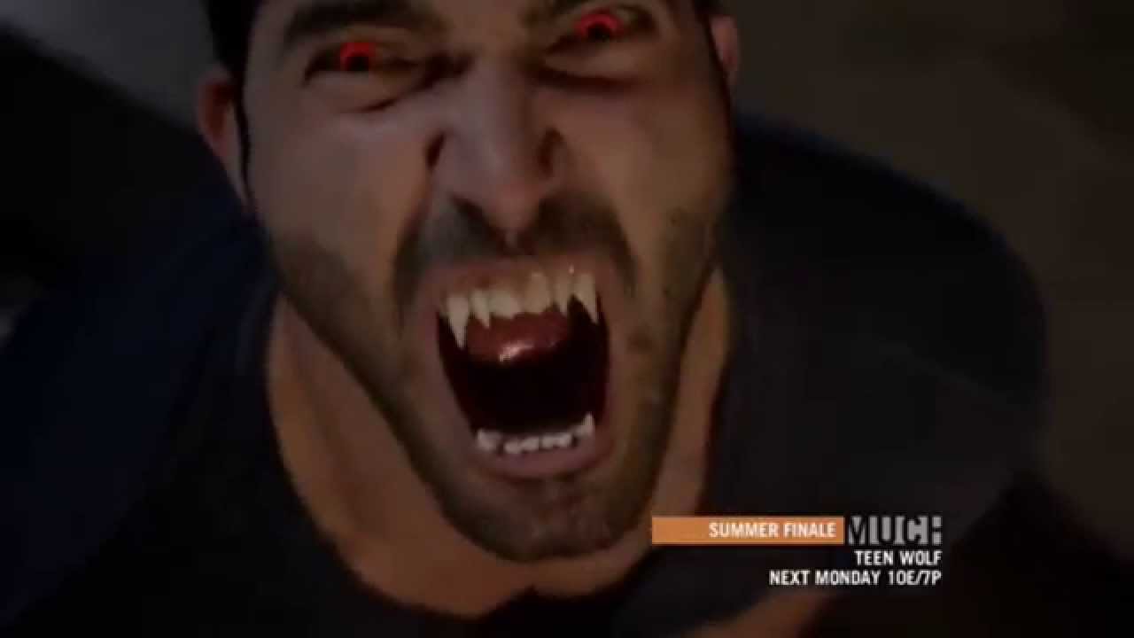 Teen Wolf - Roar