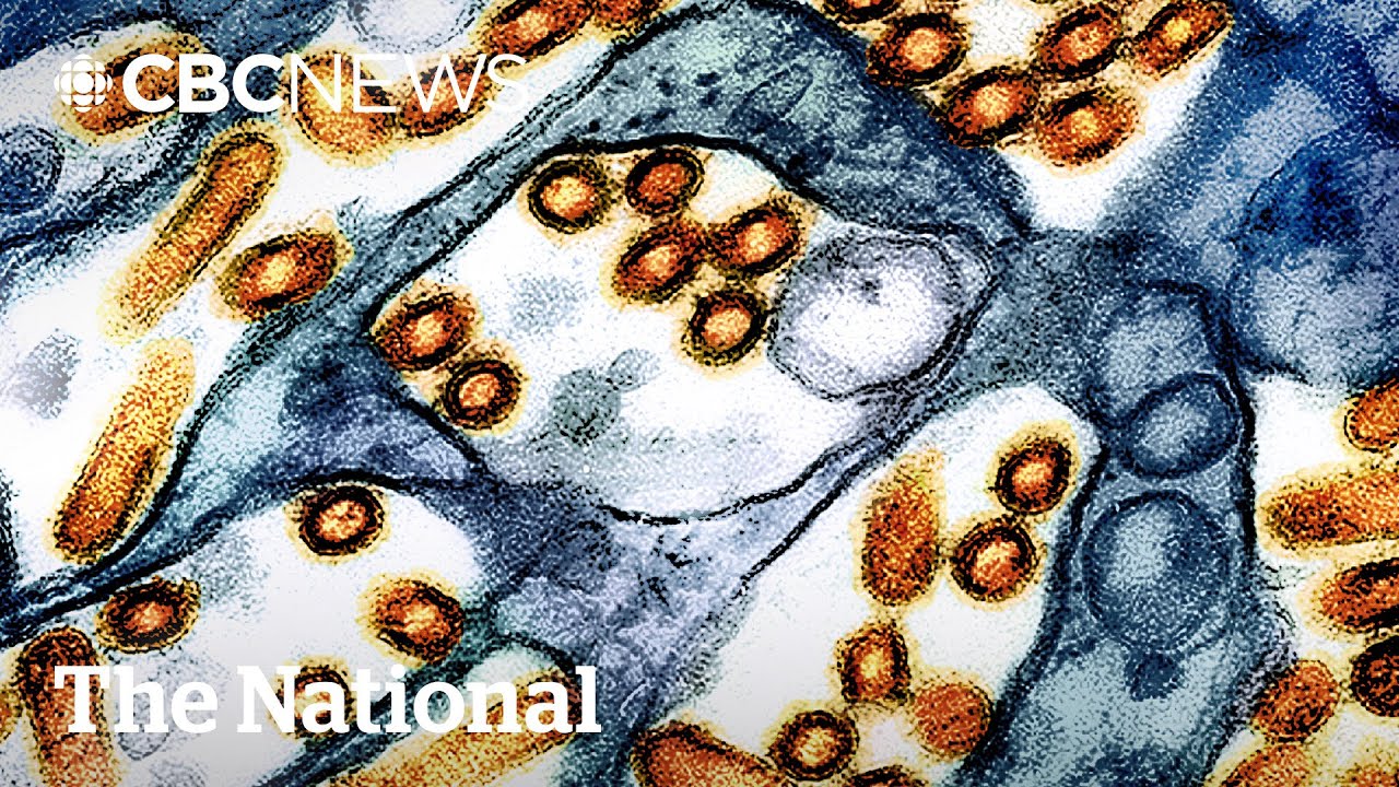 Teen has Canada&rsquo;s 1st presumptive human H5N1 avian flu case