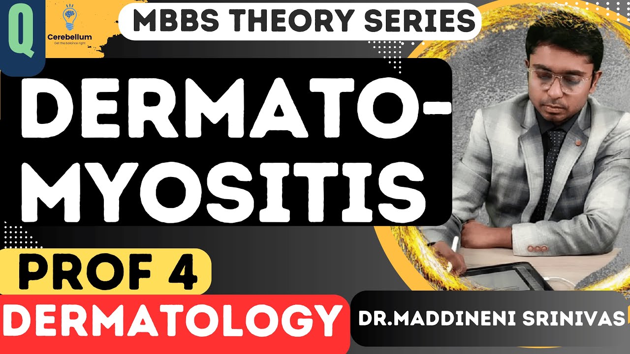 Dermatomyositis | MBBS 4th Year Dermatology Theory Question and Answer | Dr Maddineni Srinivas