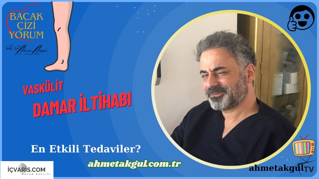 Vaskülit (Damar İltihapları) Teşhisi ve Tedavi Yöntemleri: Uzman Rehberi - Prof. Dr. Ahmet AKGÜL