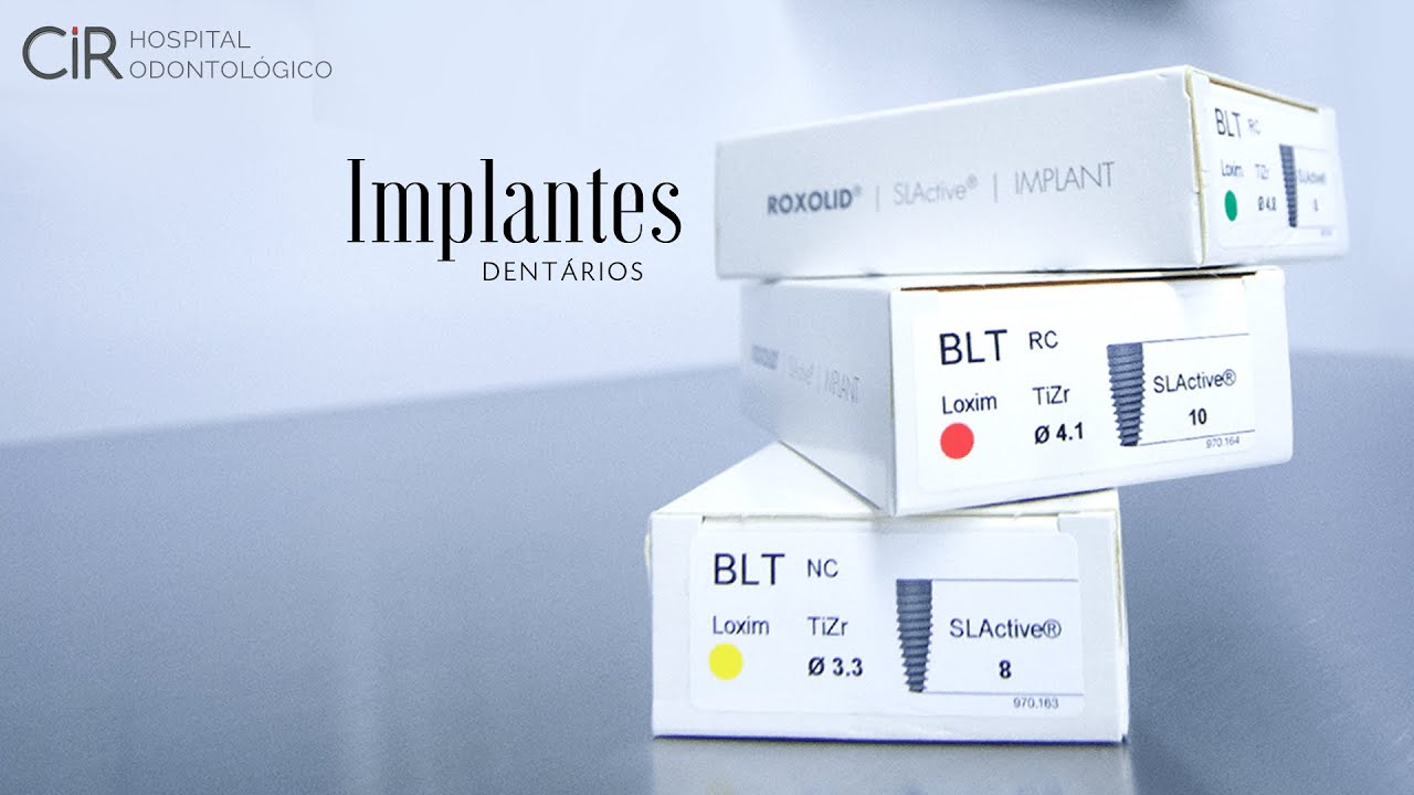 Melhores marcas de Implantes Dentários.