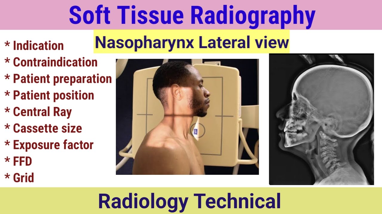 Soft tissue Radiography # Nasopharynx lateral view X-ray # STN x-ray projection# Patient positioning
