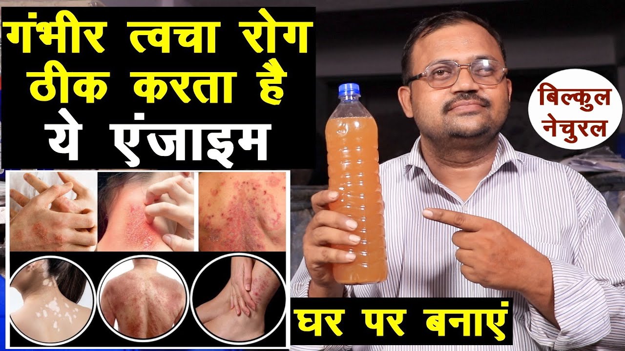 गंभीर त्वचा रोग ठीक करता है ये नेचुरल एंजाइम, घर पर बनाएं Skin Diseases Natural Treatment