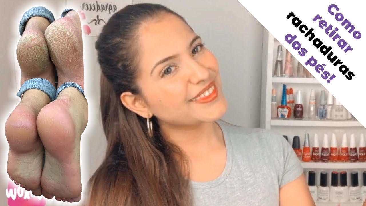 Remoção de rachaduras e calosidades dos pés 🦶 😱😱