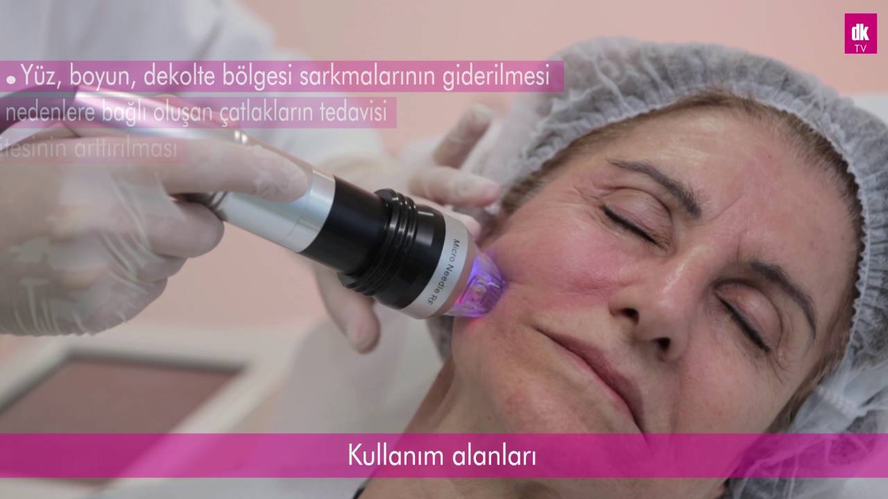 Intracel Altın İğne Tedavisi | Antalya | DK Klinik