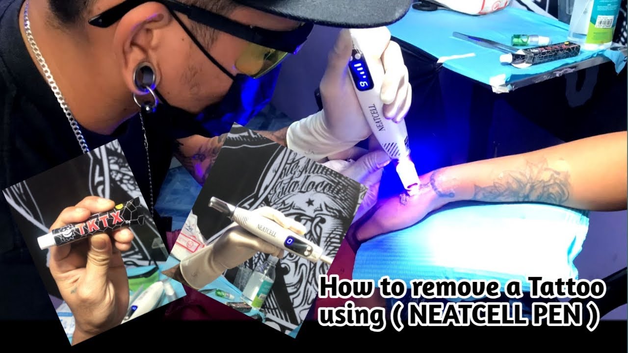 How To Remove A TaTToo (Session 2 )  | Using NeatCell Pen | Ground Zero