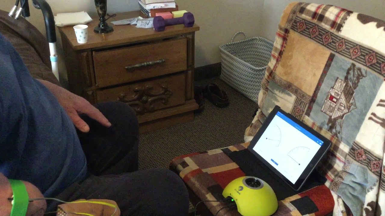 Myo testing for prosthetic arm