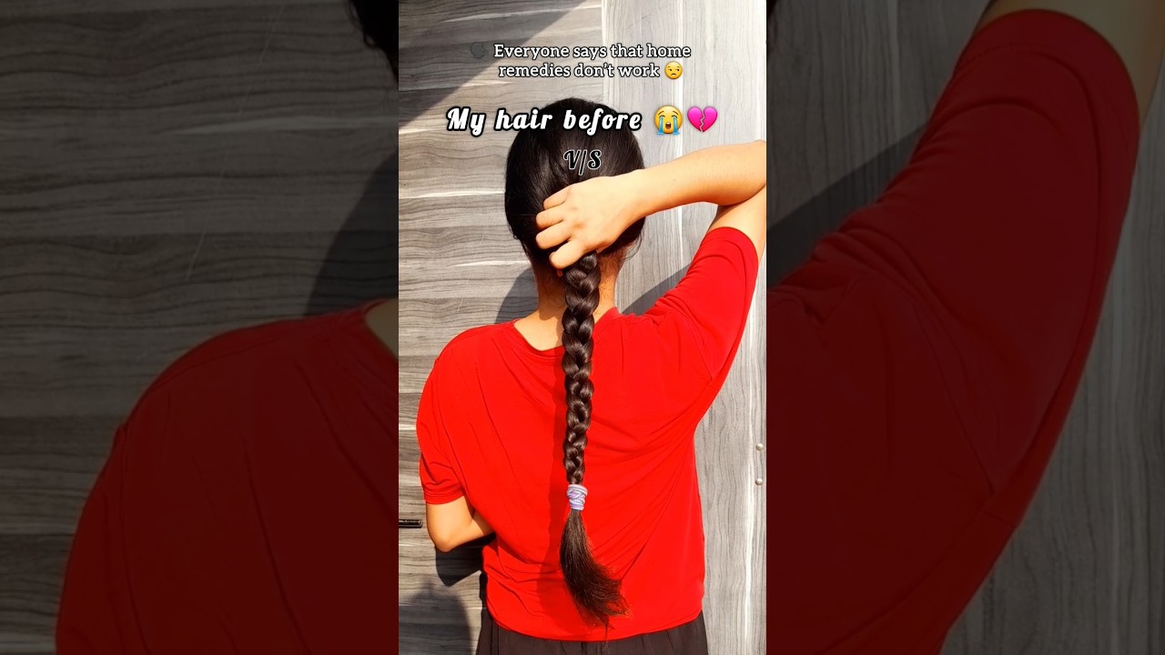 My Hair care journey |Diy hair growth serum #hair #journey #haircare #hairgrowth #shorts #viral #diy