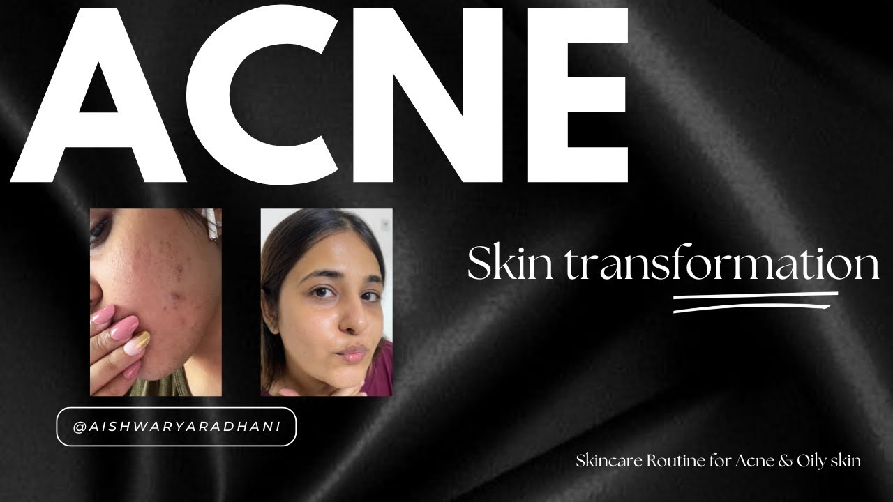 Oriflame Pure Skin Full Routine Review
