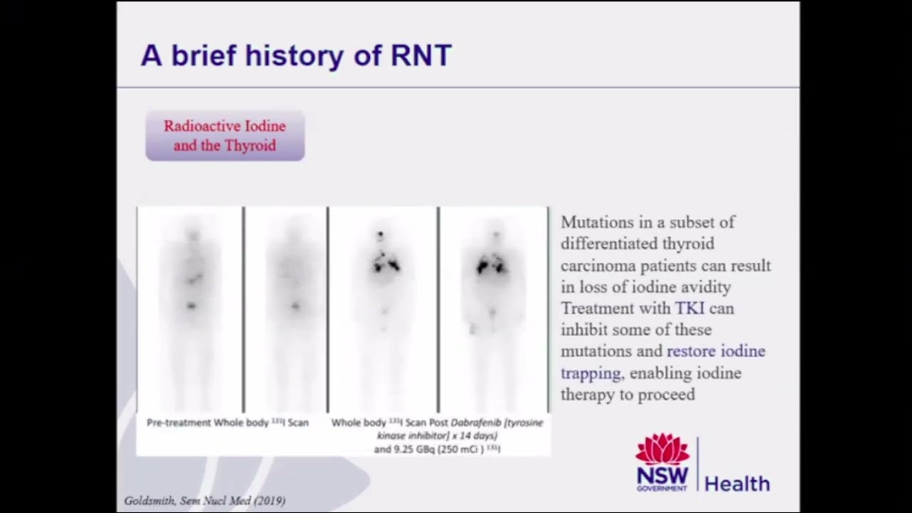 Radionuclide Therapy and Dosimetry : Current Practice and Future Direction