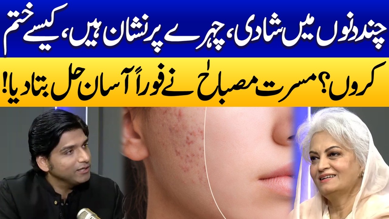 Women&rsquo;s Major Skin Problem Solved | Musarrat Misbah Shares a Quick Remedy for Facial Marks