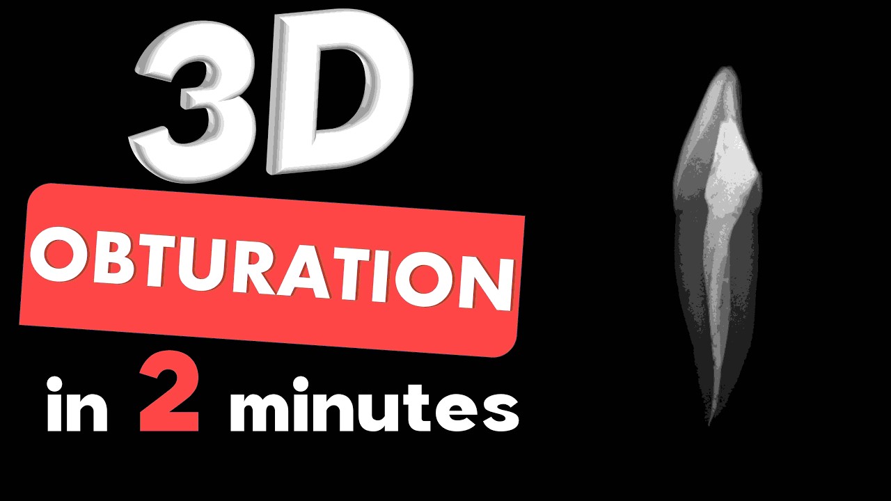 3D ОБТУРАЦИЯ | Обтурация гуттафлоу