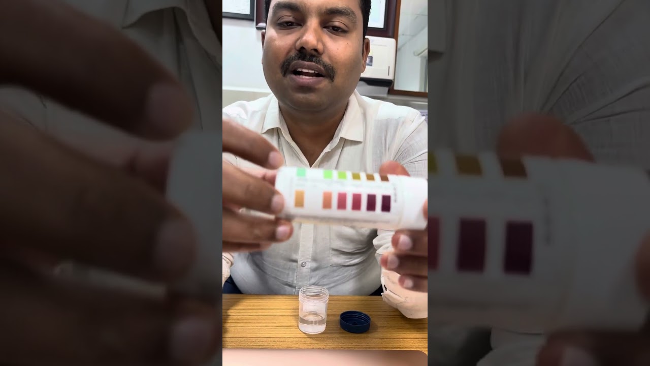 How to check urine ketones for your child on ketogenic diet - Tamil Dr. Ranjith