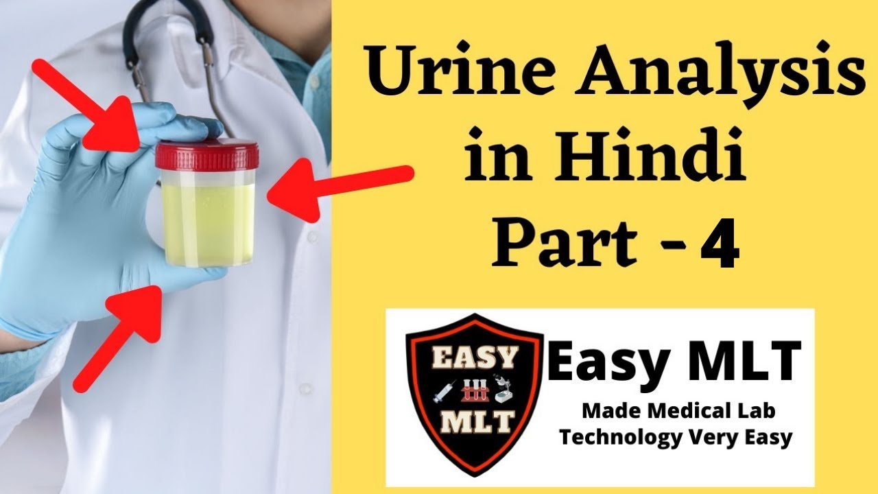 microscopic examination in hindi | urine analysis part - 4 | @myupchar_health_care_solution