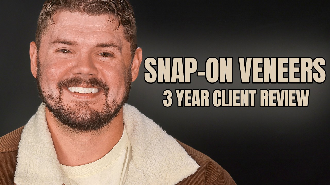 Snap-On Veneers - No Dentist Visit - Why I Chose $895 Dental Veneers Over a $30K Smile Makeover