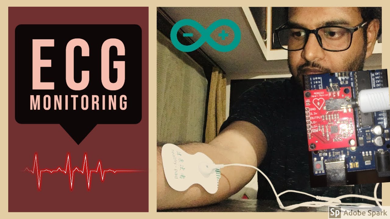 ECG Monitoring system with AD8232 Sensor || Arduino and AD8232 sensor based ECG Monitoring system