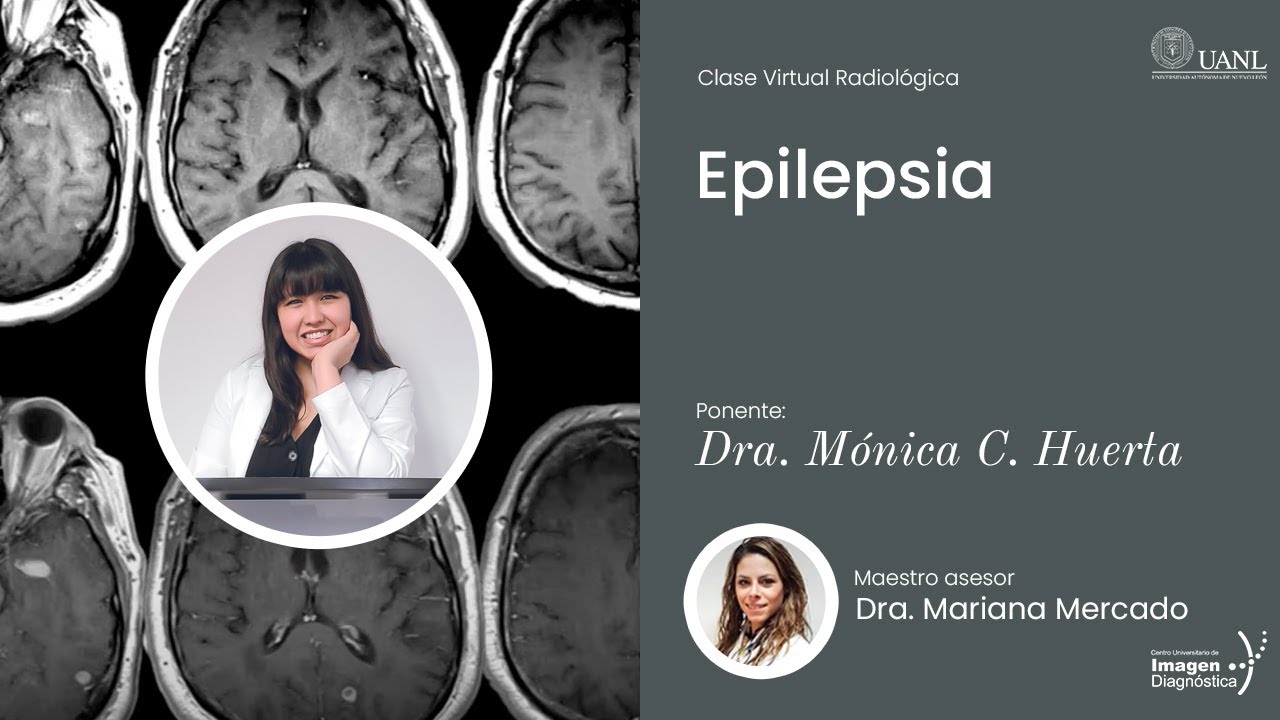 Epilepsia por la Dra. Mónica Catalina Huerta Sánchez