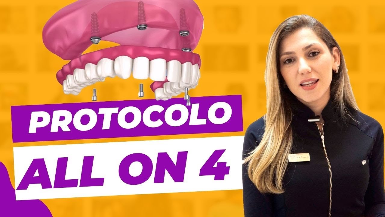 Oque é Prótese Protocolo All on 4? Por que é sem Enxerto? - Heal Odontologia