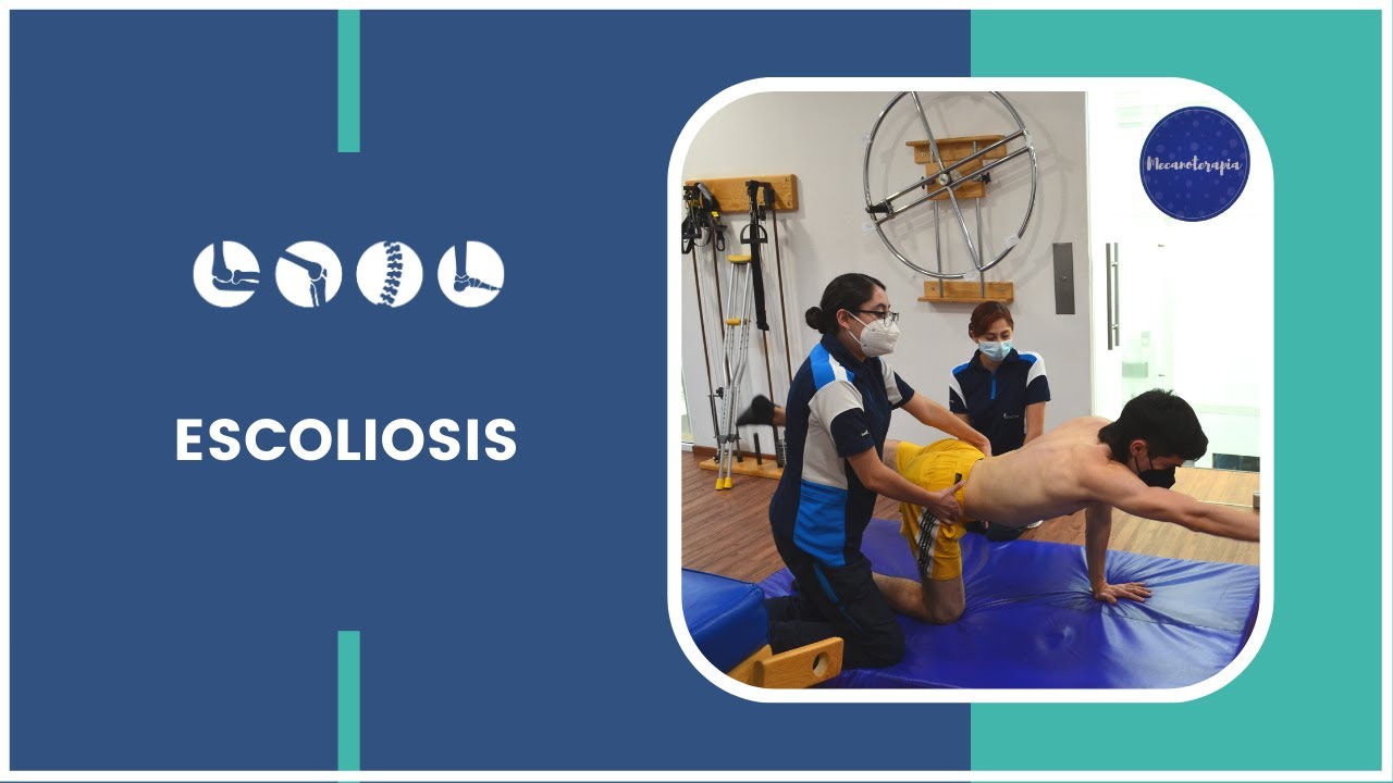 TRATAMIENTO DE ESCOLIOSIS | CLÍNICA DE TERAPIA FÍSICA