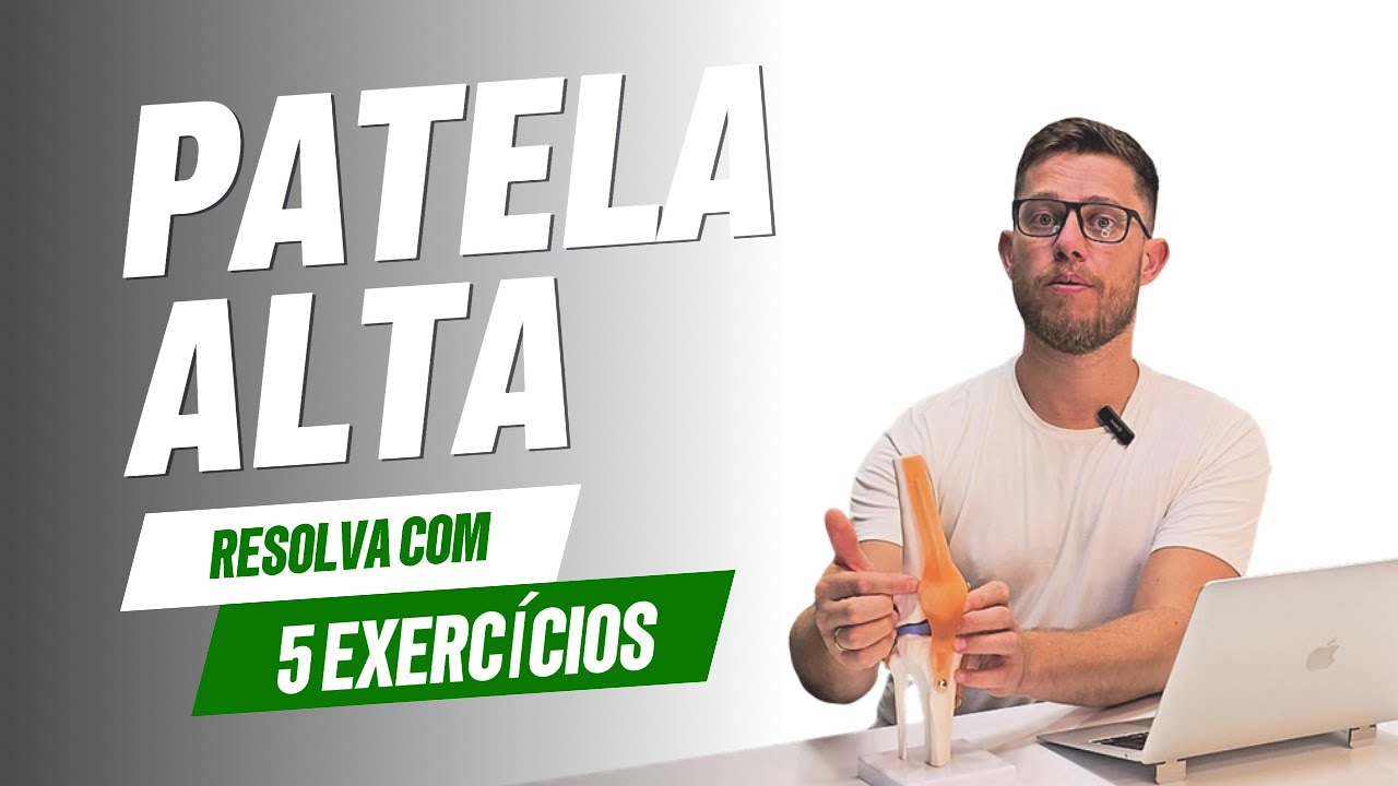 Patela Alta 5 exercícios para RESOLVER #fisioterapia #joelho #dores #exercícios #façavocêmesmo