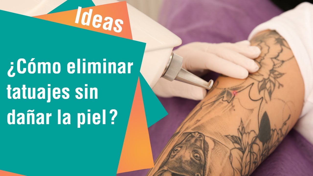 Eliminar los tatuajes sin dañar nuestra piel | Ideas