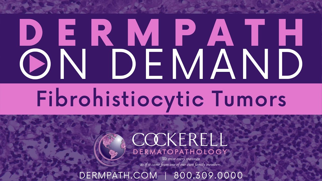 Fibrohistiocytic Tumors