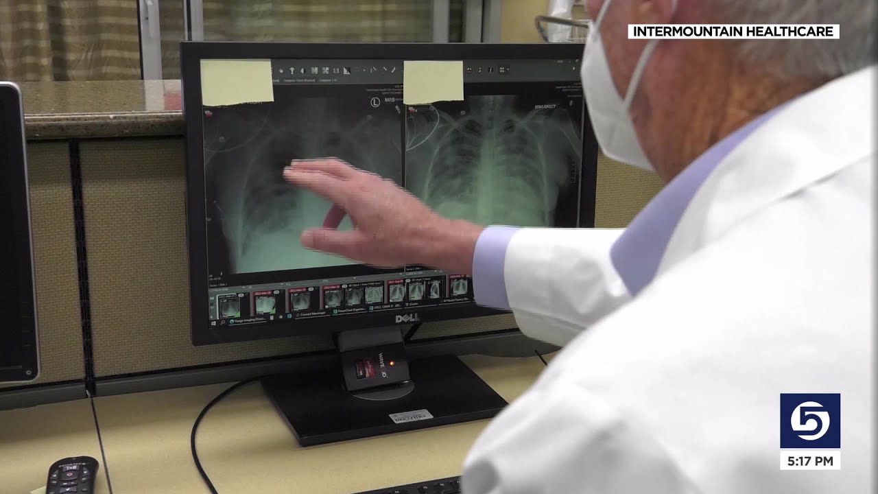 ICU doctor: &lsquo;There&rsquo;s no other system like it in the world,&rsquo; of pneumonia electronic support tool