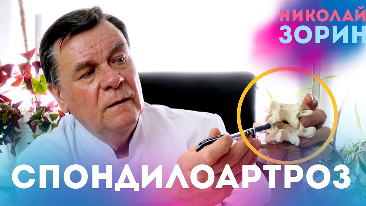 Спондилоартроз. Ответы на вопросы зрителей