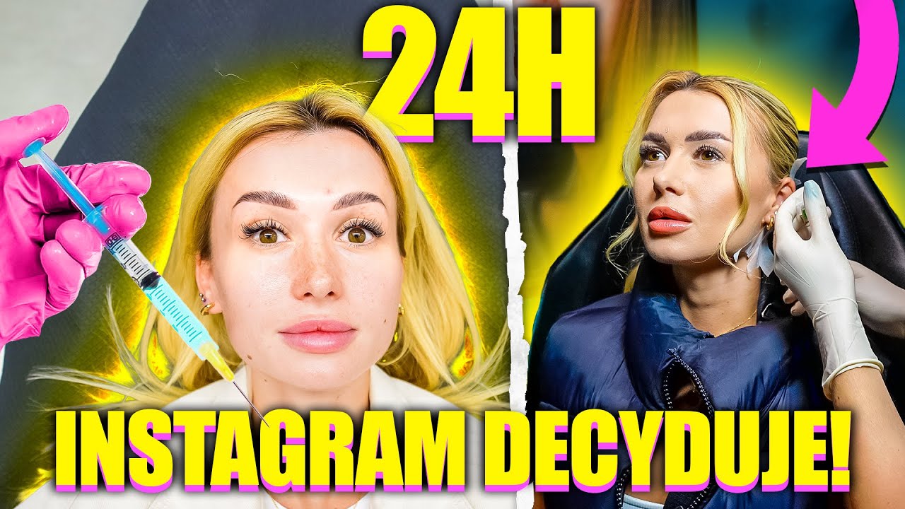 WIDZOWIE DECYDOWALI O MOICH ZABIEGACH PRZEZ 24H!