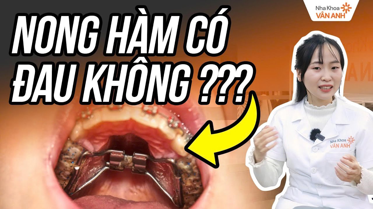 Nong Hàm Có Đau Không? Xem Ngay 3 Giai Đoạn 
