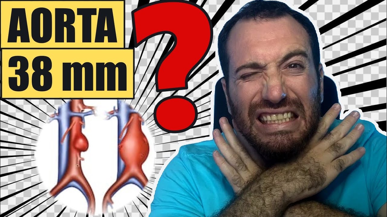Aorta de 38 mm é perigoso? o que é ectasia de aorta?