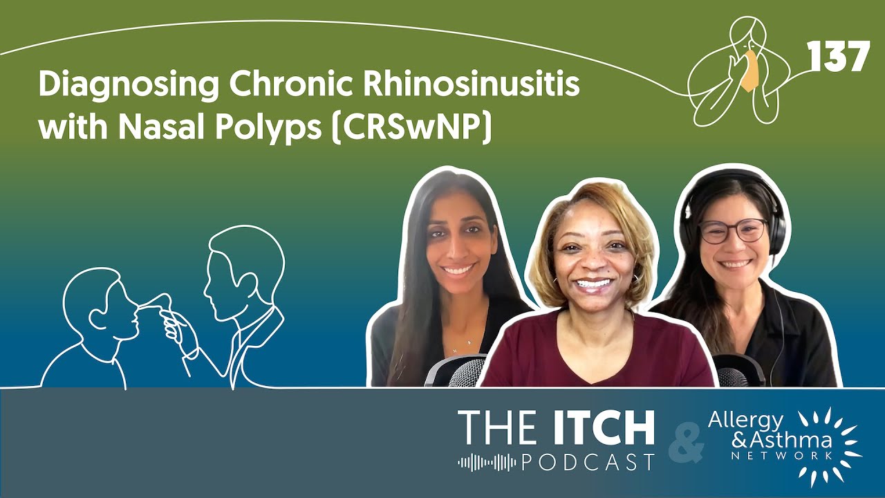 How Chronic Rhinosinusitis with Nasal Polyps (CRSwNP) Is Diagnosed