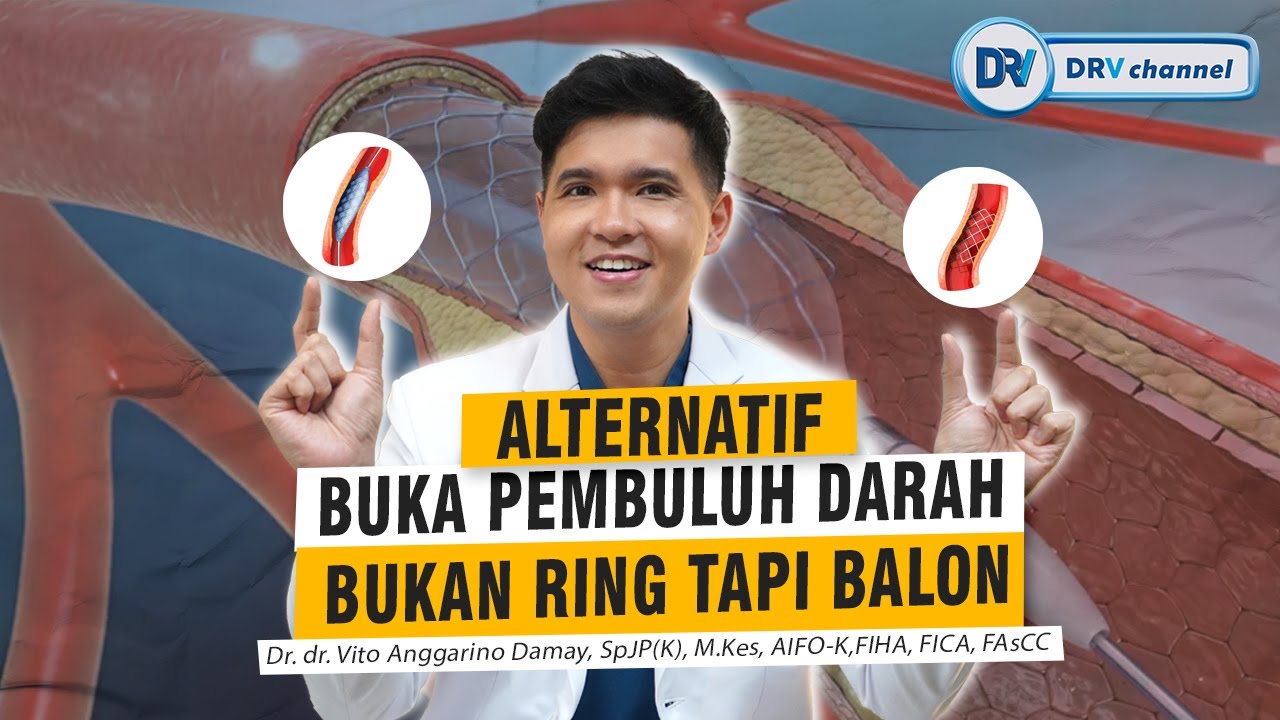 Dr Vito | Alternatif Buka Pembuluh Darah, Bukan Ring Tapi Balon