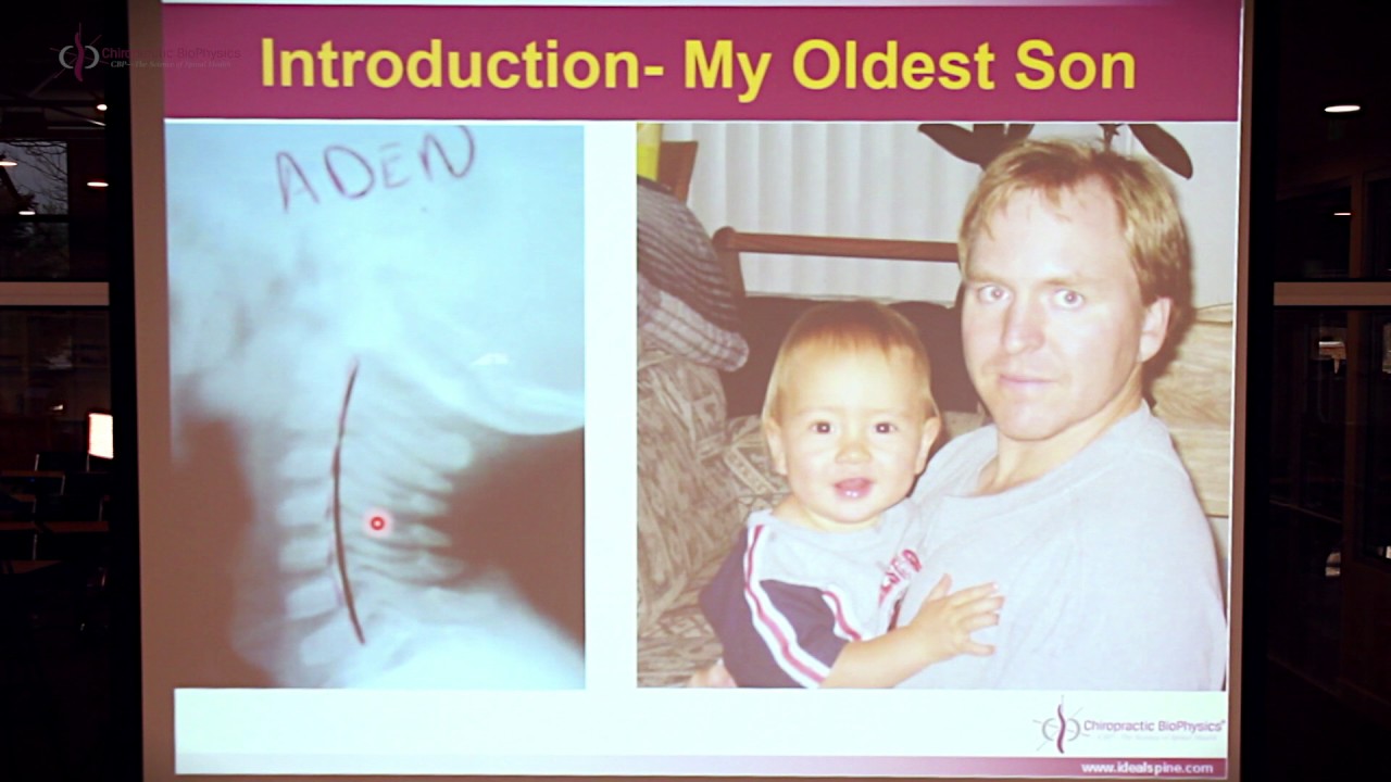 CBP NP 47: Restoration of Pediatric Cervical Lordosis